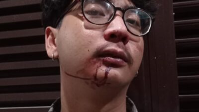 Koordinator BEM Nusantara Jatim yang Juga Finalis Cak Ning Surabaya Aniaya Mahasiswa UWKS